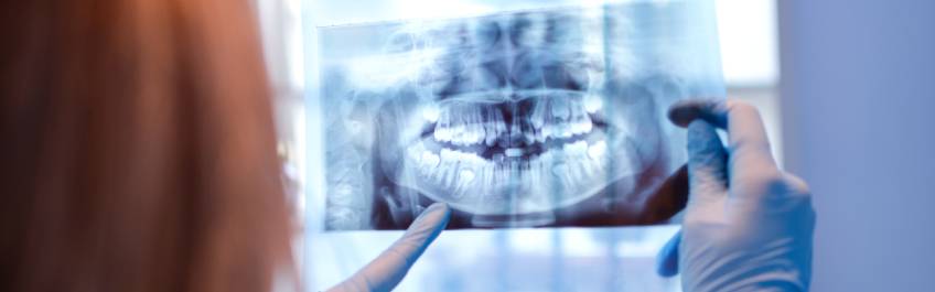 ahoa escaner dentista implantes