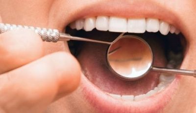 ¿Me puedo poner implantes dentales si tengo una enfermedad periodontal?